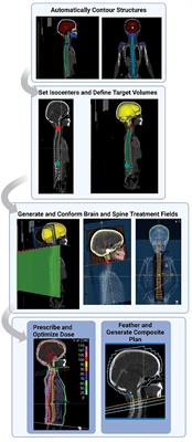 Validation of an automated contouring and treatment planning tool for pediatric craniospinal radiation therapy